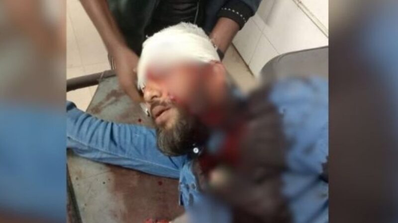 এবার এনসিপির খুলনা বিভাগীয় প্রধান মোতালেব গুলিবিদ্ধ