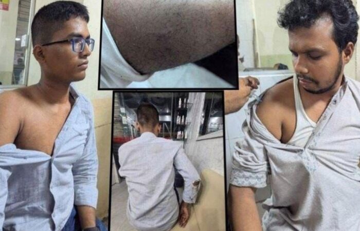 শাহবাগ থানার ভেতরেই ঢাবির ১০ সাংবাদিকের ওপর ভয়াবহ হামলা