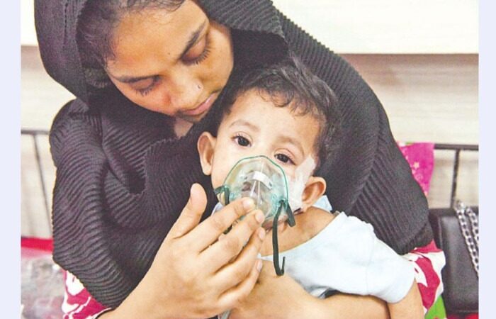 হাম ও হামের উপসর্গে আরও ৭ শিশুর মৃত্যু, এ পর্যন্ত মৃত্যু ৪৩৯